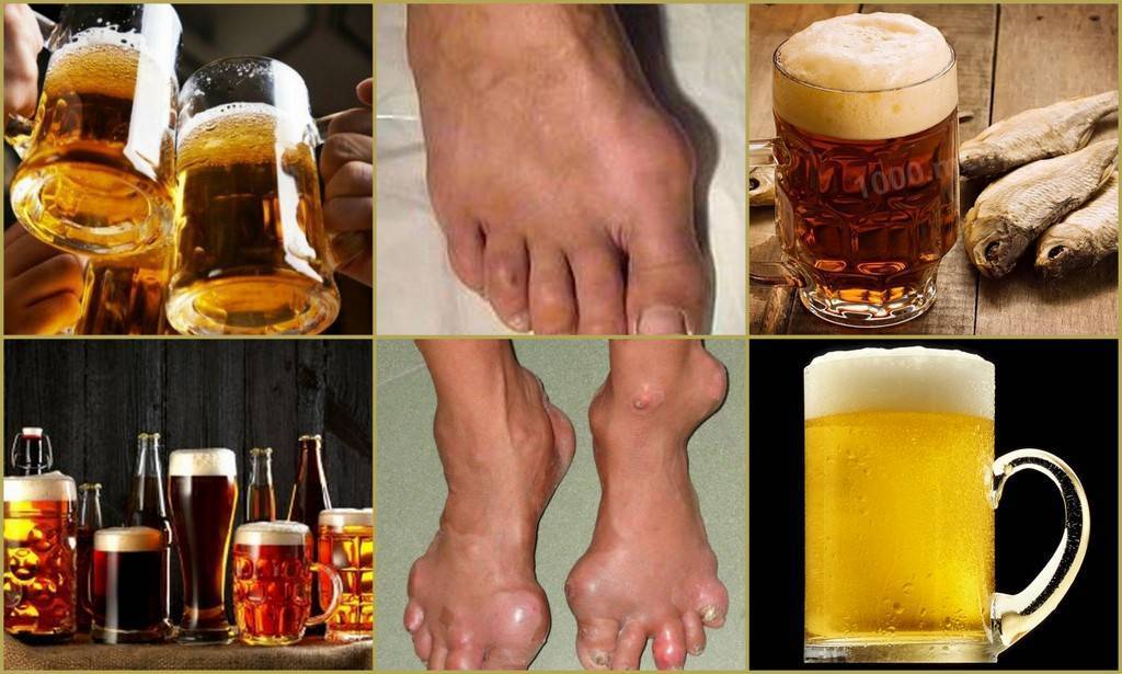 Можно ли пить пиво в бане – последствия для здоровья - мы здоровы!